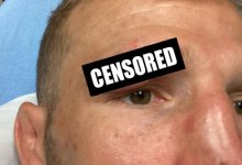 TJ Dillashaw withdraws from UFC comeback fight vs. Cory Sandhagen, citing facial cut